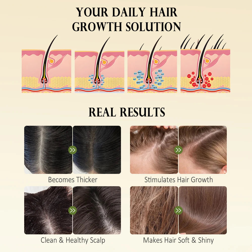 Rosemary Mint Hair Growth Oil Private Label Hair Care Scalp Nourishing Treatment Oil for Women Men OEM ODM Cosmetic Wholesale